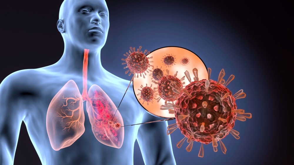 www.news-medical.net