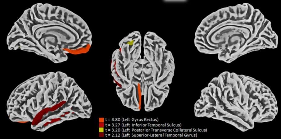 neurosciencenews.com